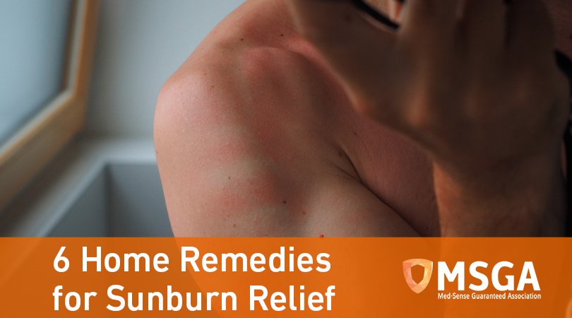 6 Home Remedies for Sunburn Relief
